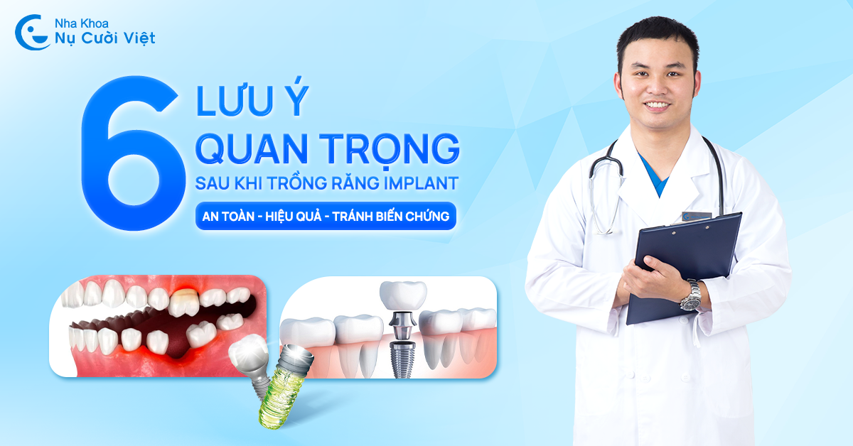 6 lưu ý chăm sóc sau khi trồng răng implant
