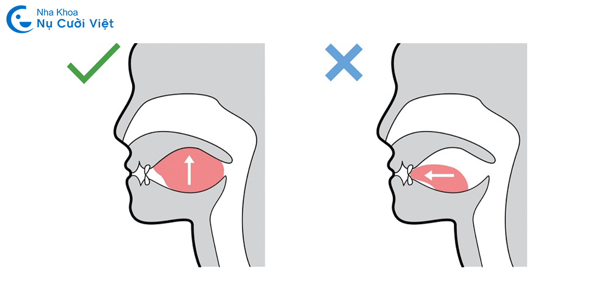 Bài tập Mewing khắc phục cằm lẹm tại nhà