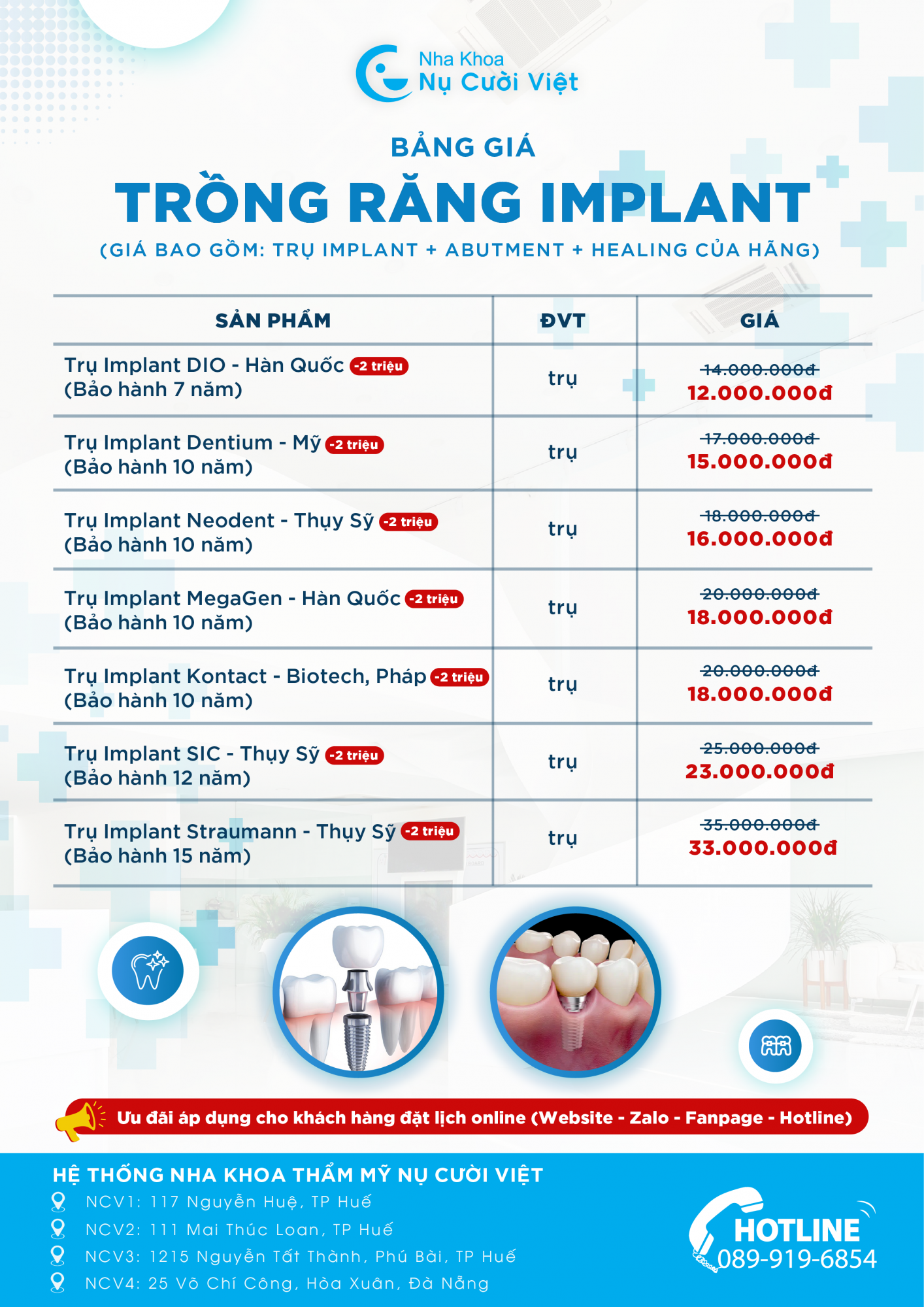 bảng giá implant mới nhất tại nụ cười việt