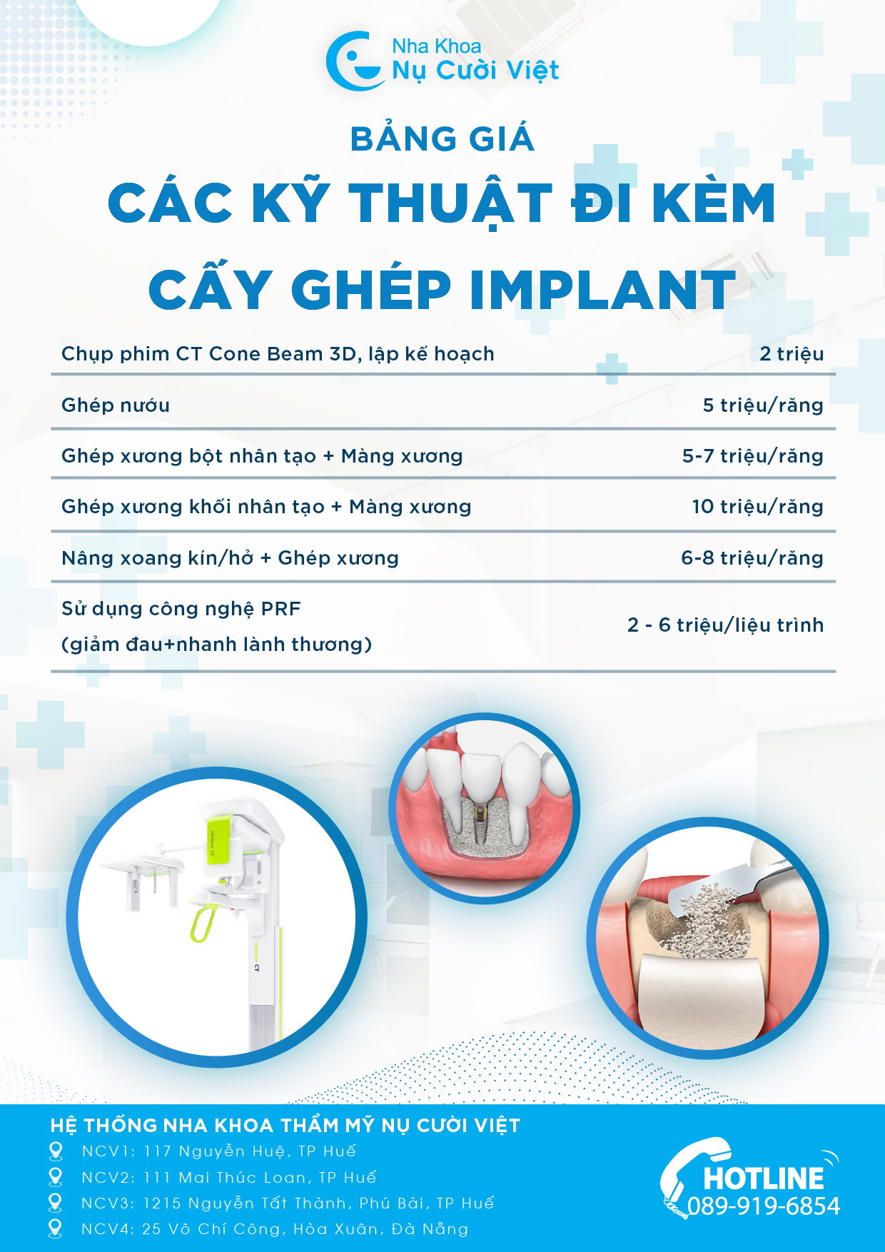 bảng giá các kỹ thuật trồng răng implant