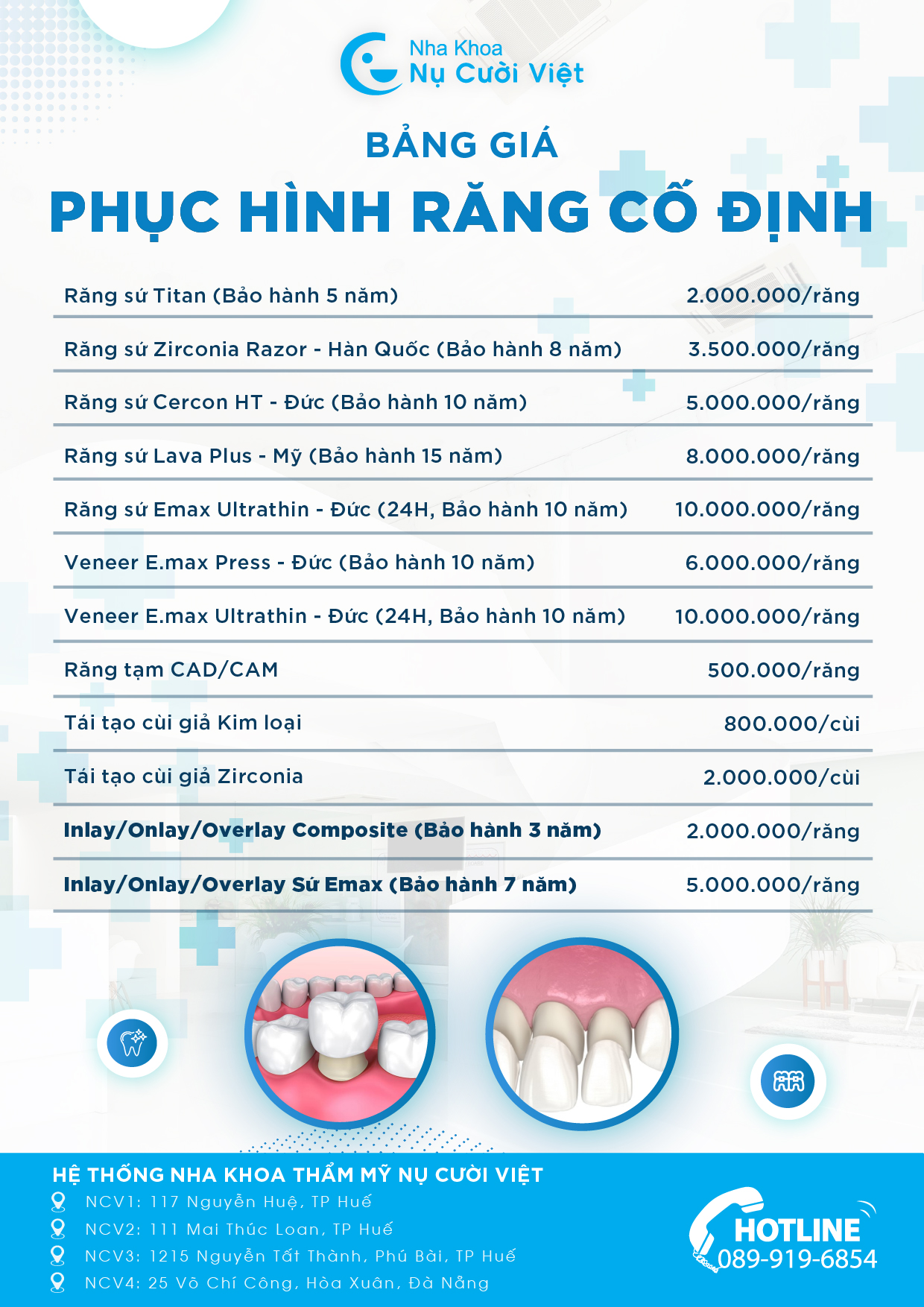 bảng giá răng sứ