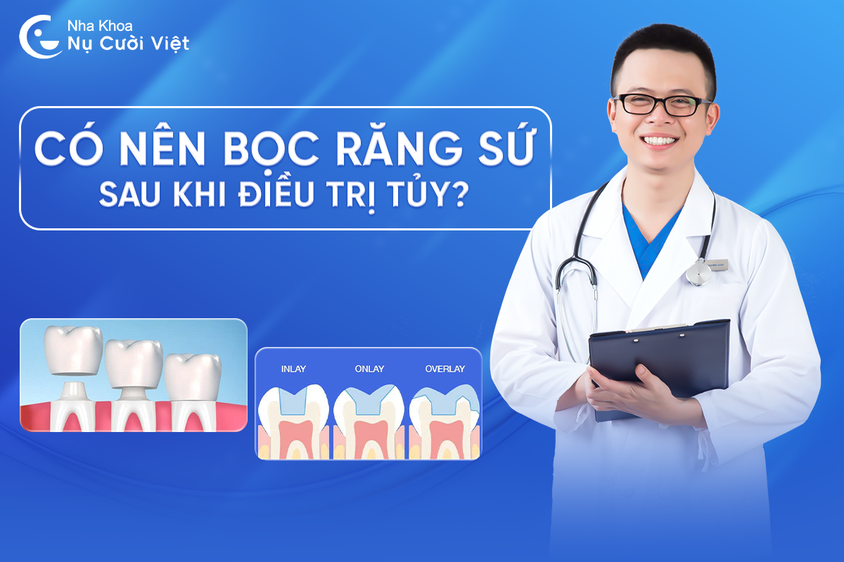 Nụ Cười Việt - Giải đáp thắc mắc: Có nên bọc răng sứ sau khi điều trị tủy