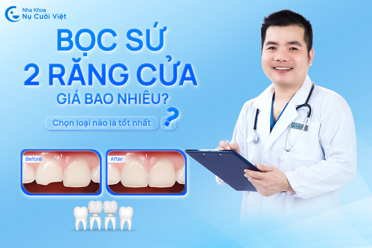 Nụ Cười Việt - BỌC SỨ 2 RĂNG CỬA GIÁ BAO NHIÊU? NÊN CHỌN LOẠI NÀO LÀ TỐT NHẤT?