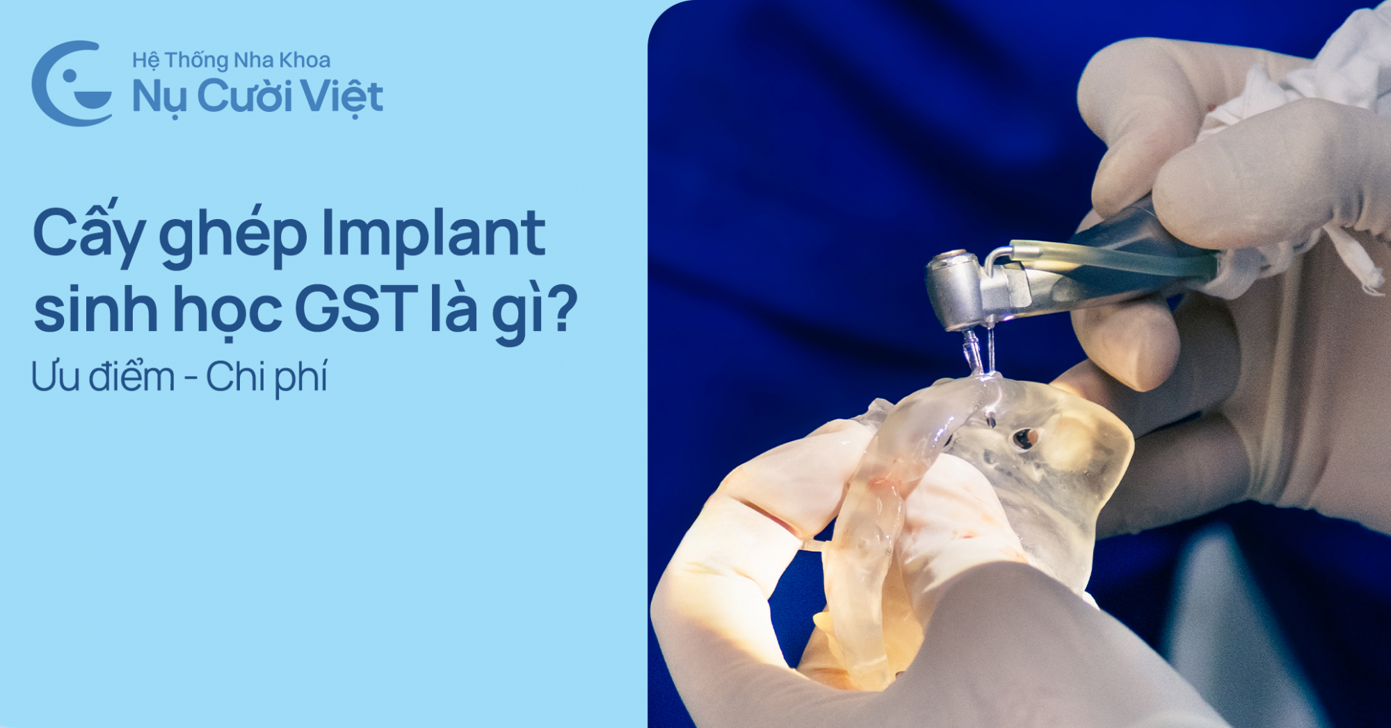 cấy ghép implant sinh học gst là gì