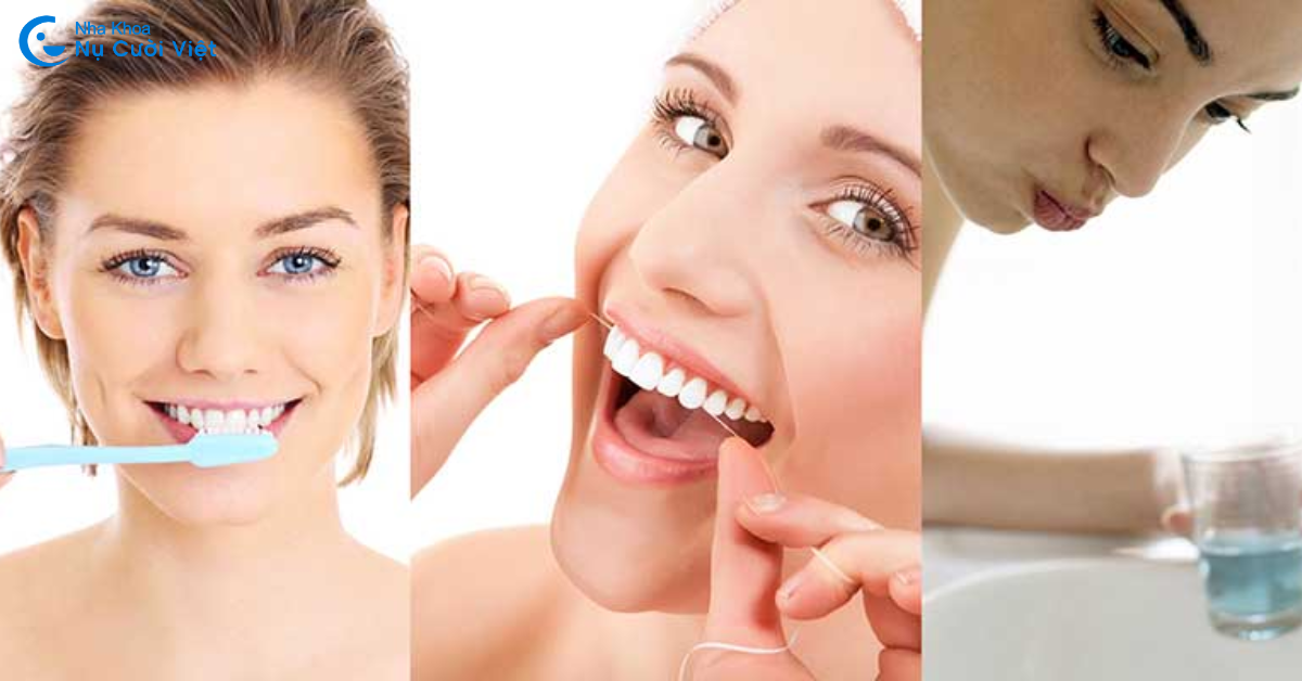 chăm sóc sau khi trồng răng implant