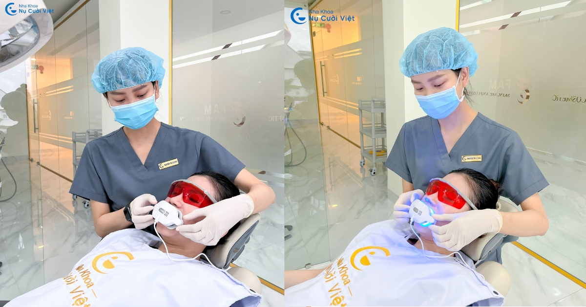 tẩy trắng răng bằng laser tại nha khoa nụ cười việt