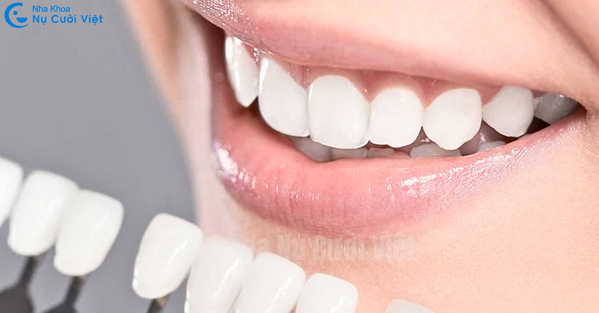dấu hiệu răng sứ bị mòn hoặc hư hại sớm
