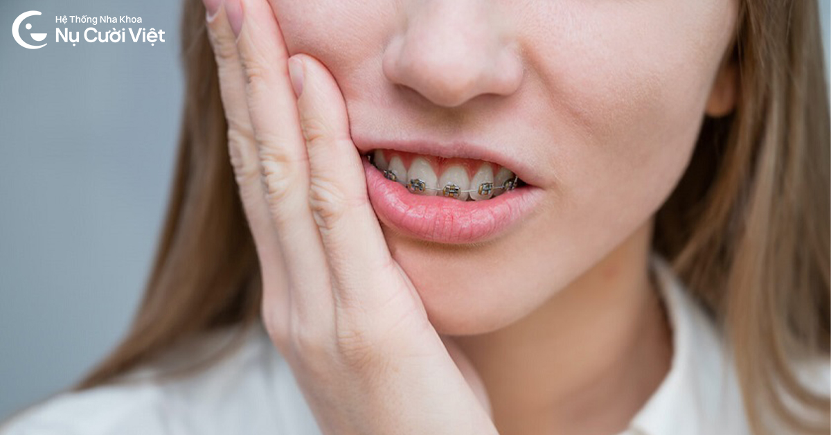 cảm giác ê buốt khi mới niềng răng