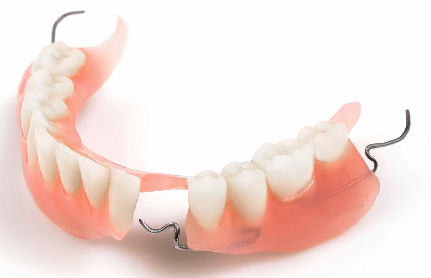 hàm tháo lắp phục hình răng mất số 7