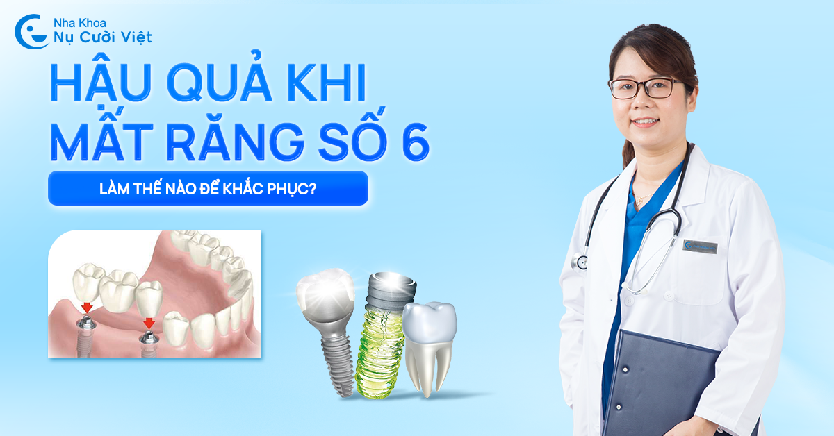hậu quả của mất răng số 6 nha khoa nụ cười việt