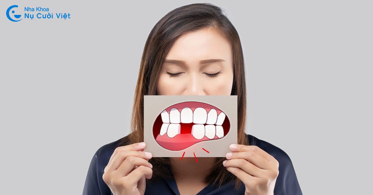hậu quả của mất răng 