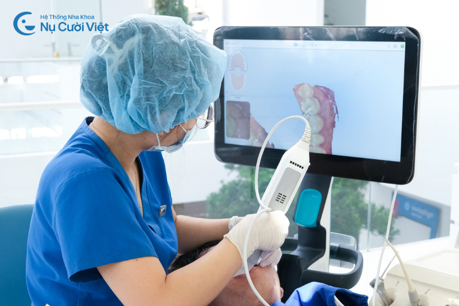 lấy dấu implant scan 3d
