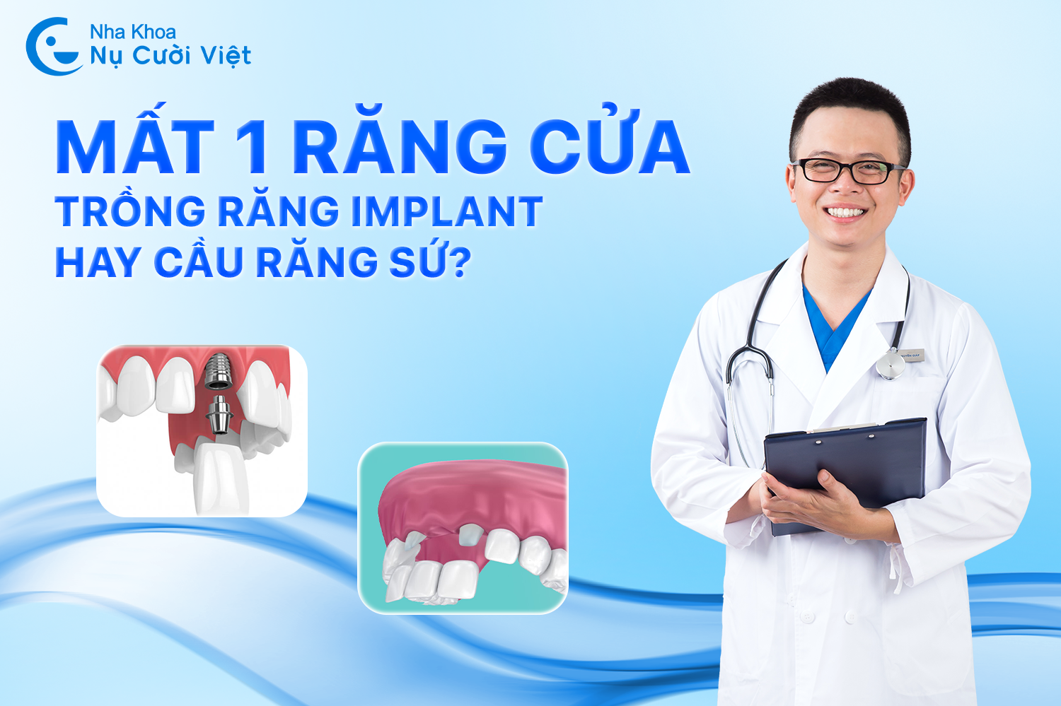 Nụ Cười Việt - CÁCH XỬ LÝ KHI MẤT 1 RĂNG CỬA: TRỒNG RĂNG IMPLANT HAY CẦU RĂNG SỨ? 