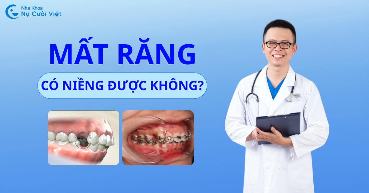 mất răng có niềng được không