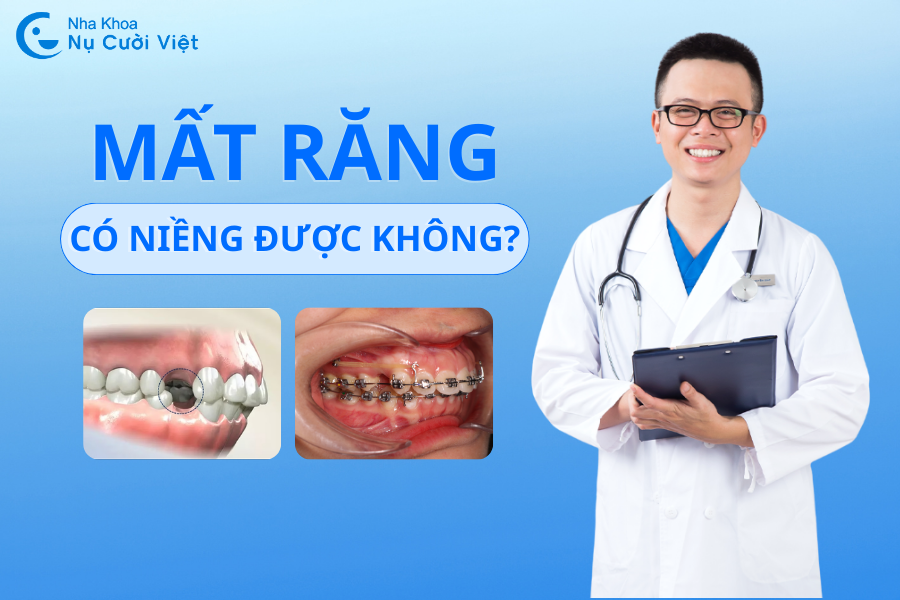 Nụ Cười Việt - MẤT RĂNG CÓ NIỀNG ĐƯỢC KHÔNG? CÓ CẦN TRỒNG IMPLANT KHÔNG?
