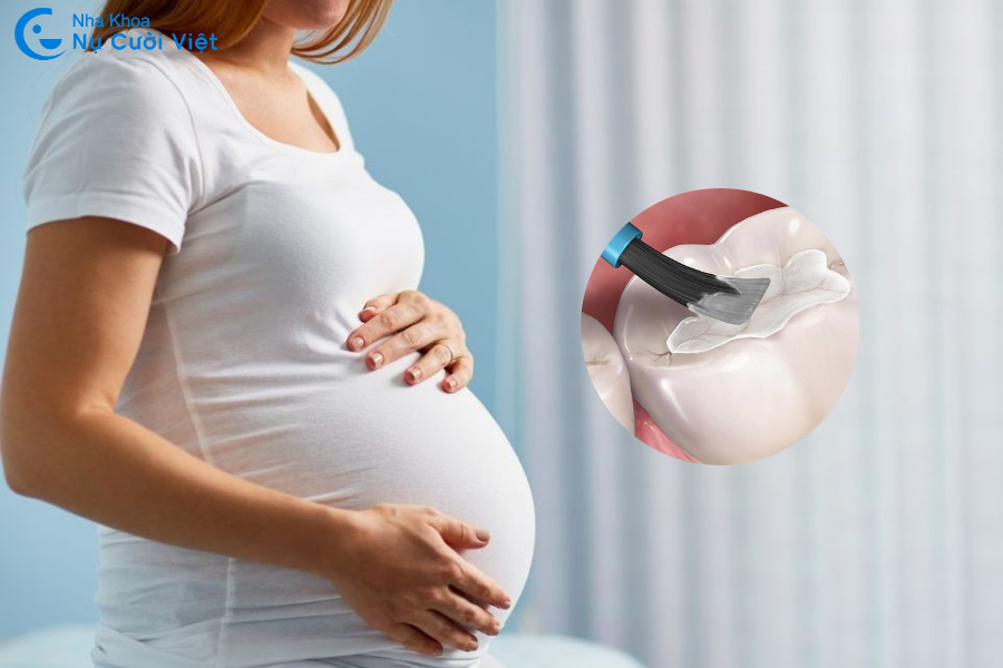 Nụ Cười Việt - Mẹ bầu có trám răng được không? Thời điểm nào an toàn nhất để điều trị?