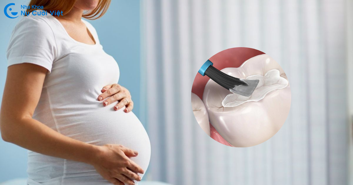 mệ bầu trám răng có được không