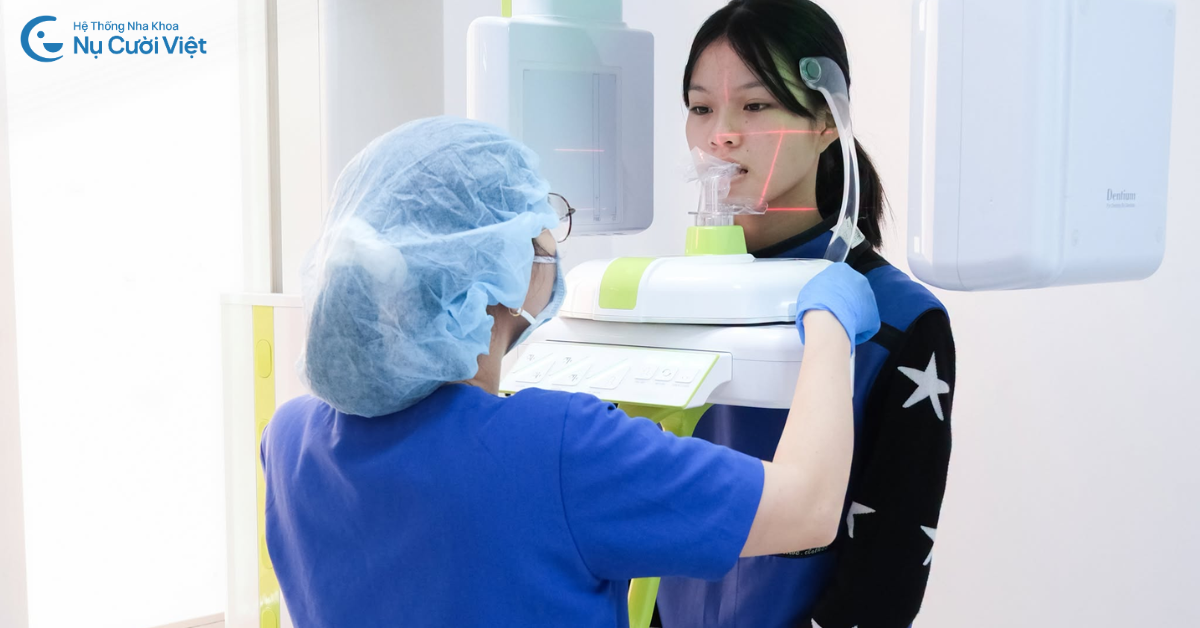 nha khoa cấy ghép implant uy tín tại Huế