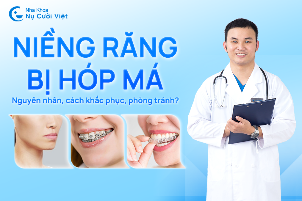 Nụ Cười Việt - Niềng răng bị hóp má: Nguyên nhân, cách khắc phục &  Làm sao để phòng tránh? 
