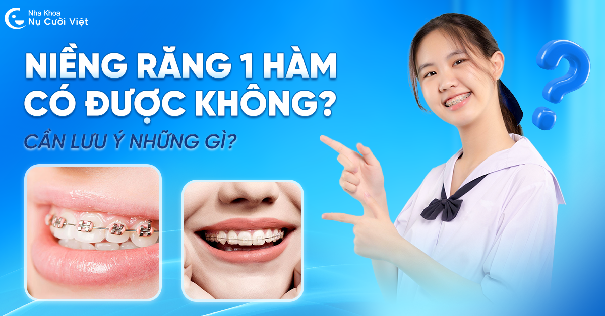 Niềng răng một hàm có được không? Cần lưu ý những gì?