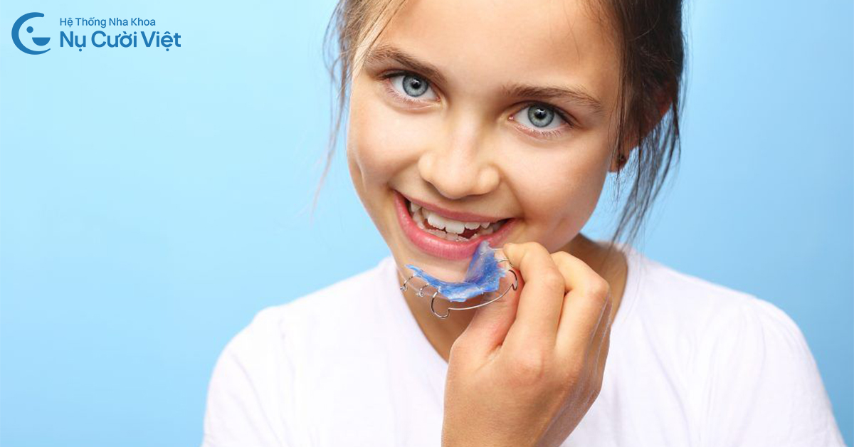 chi phí niềng răng cho trẻ em