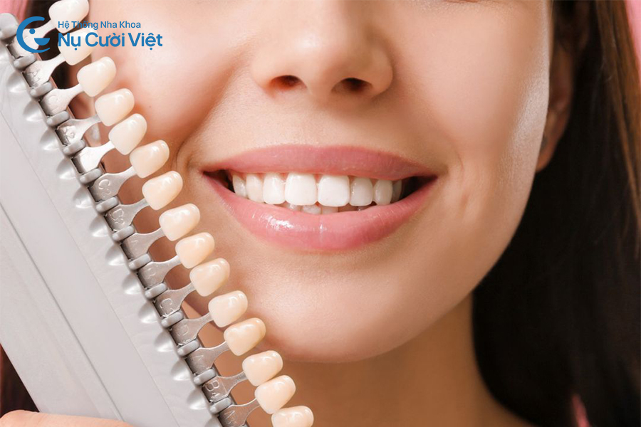 Nụ Cười Việt - RĂNG KHẤP KHỂNH CÓ DÁN SỨ VENEER ĐƯỢC KHÔNG?