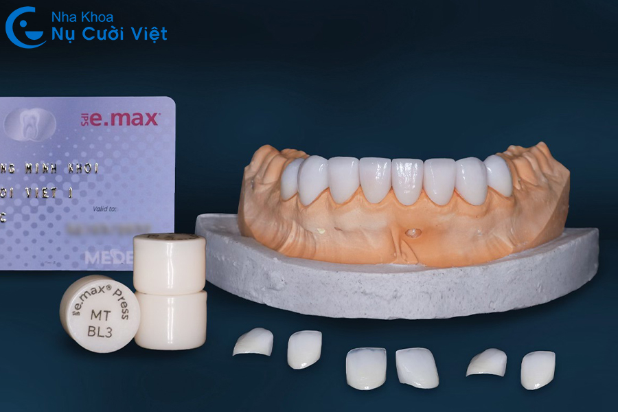 Nụ Cười Việt - Răng sứ Emax là gì? Có tốt không? Giá bao nhiêu?