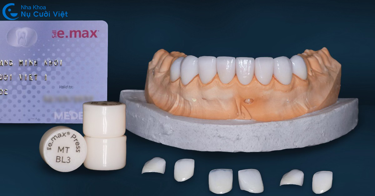răng sứ emax