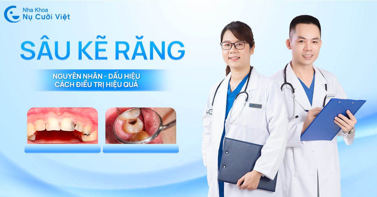 sâu kẽ răng nguyên nhân dấu hiệu và cách khắc phục