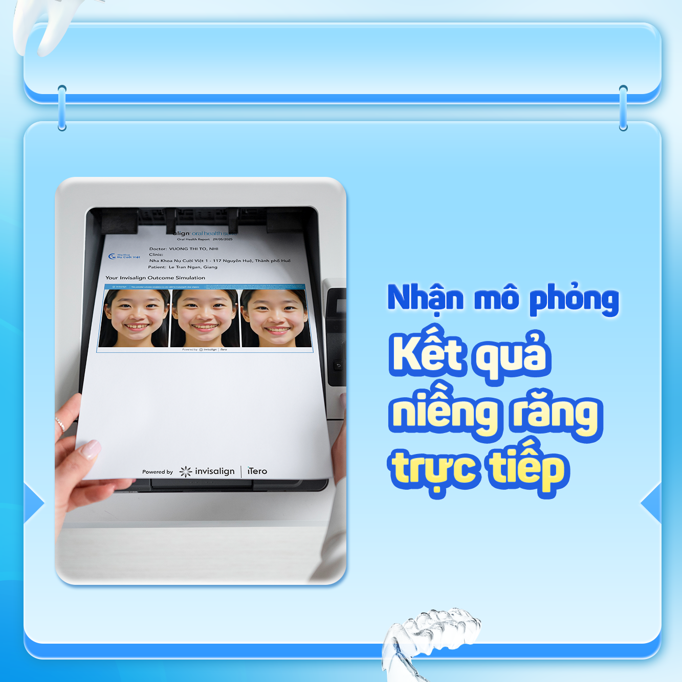 smile up day ngày hội niềng răng nụ cười việt 
