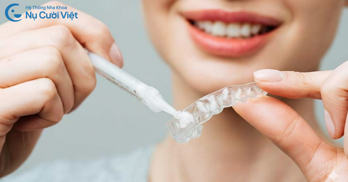 tẩy trắng răng bằng máng