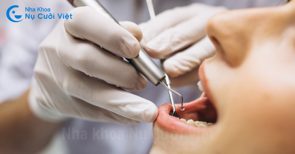 thăm khám răng miệng định kỳ 