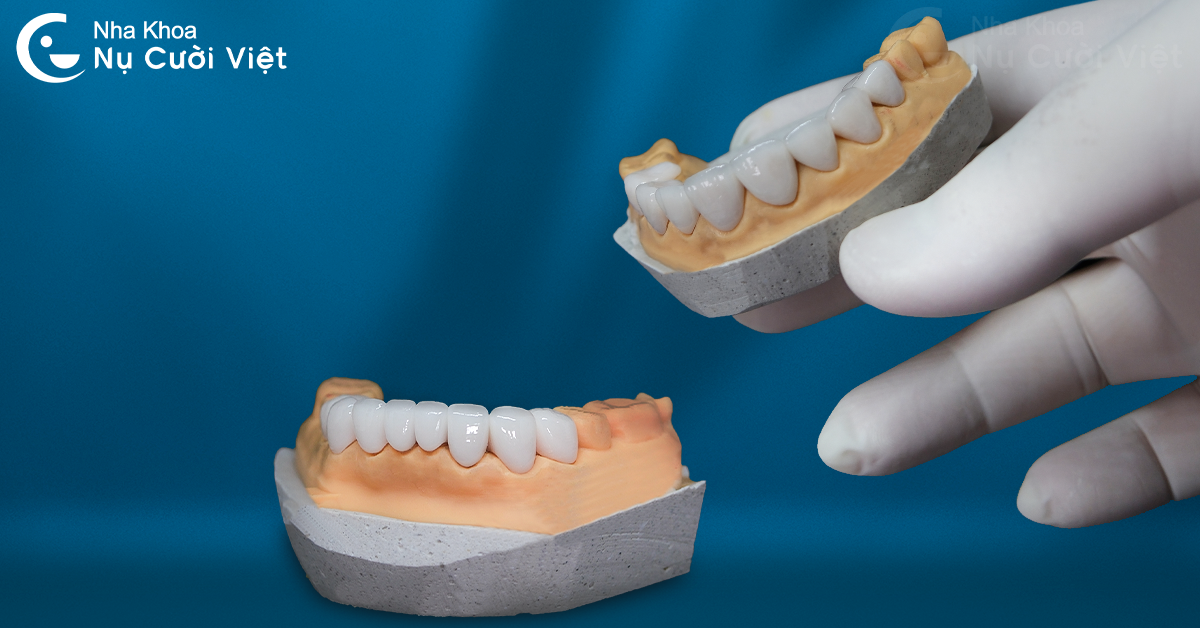 cách khắc phục khi răng sứ bị mòn