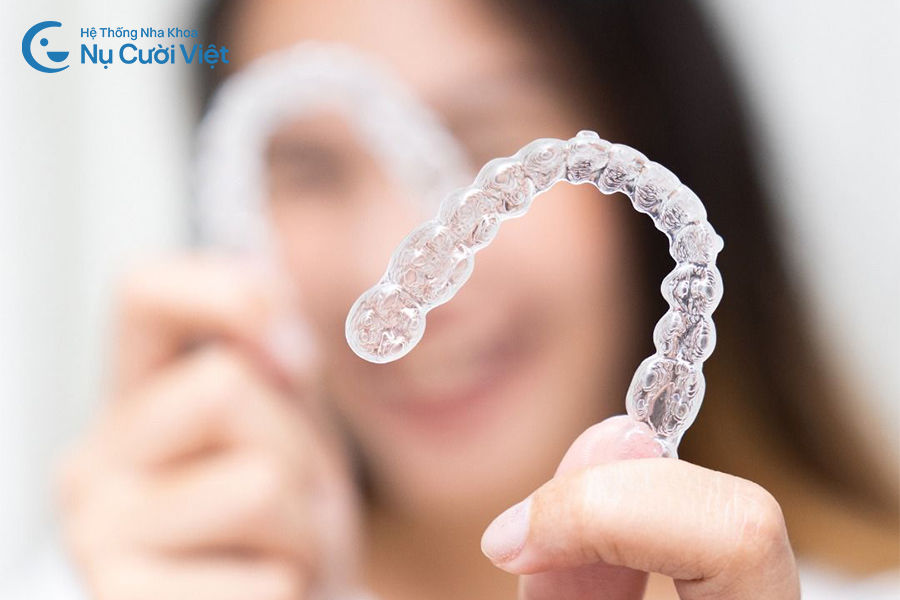 Nụ Cười Việt - Thời gian niềng răng mất bao lâu? Các yếu tố quyết định thời gian niềng răng