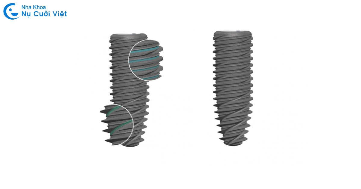 trụ implant kontact biotech pháp