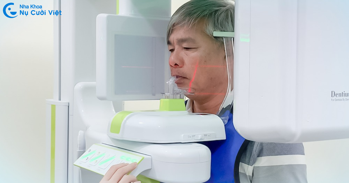trường hợp chụp phim conebeam ct 